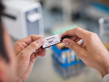 Blood sample label